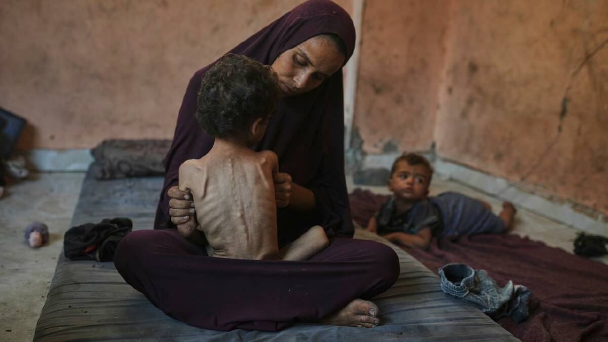 Images of starving children in the Palestinian territory have reverberated around the world. (AP PHOTO) Images of starving children in the Palestinian territory have reverberated around the world. (AP PHOTO)