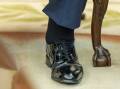 Donald Trump has chronic venous insufficiency, a condition that causes blood to pool in his veins. Photo: AP PHOTO