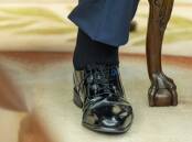 Donald Trump has chronic venous insufficiency, a condition that causes blood to pool in his veins. Photo: AP PHOTO