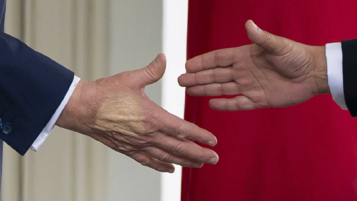 Donald Trump was seen with makeup on his hand (left) to cover bruising from 'frequent handshaking'. (AP PHOTO) Donald Trump was seen with makeup on his hand (left) to cover bruising from 'frequent handshaking'. (AP PHOTO)