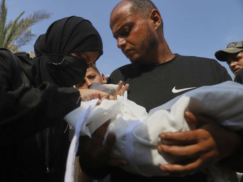 Five-month-old baby, Zainab, was allergic to cows milk and had no access to special formula in Gaza. Photo: AP PHOTO Five-month-old baby, Zainab, was allergic to cows milk and had no access to special formula in Gaza. Photo: AP PHOTO