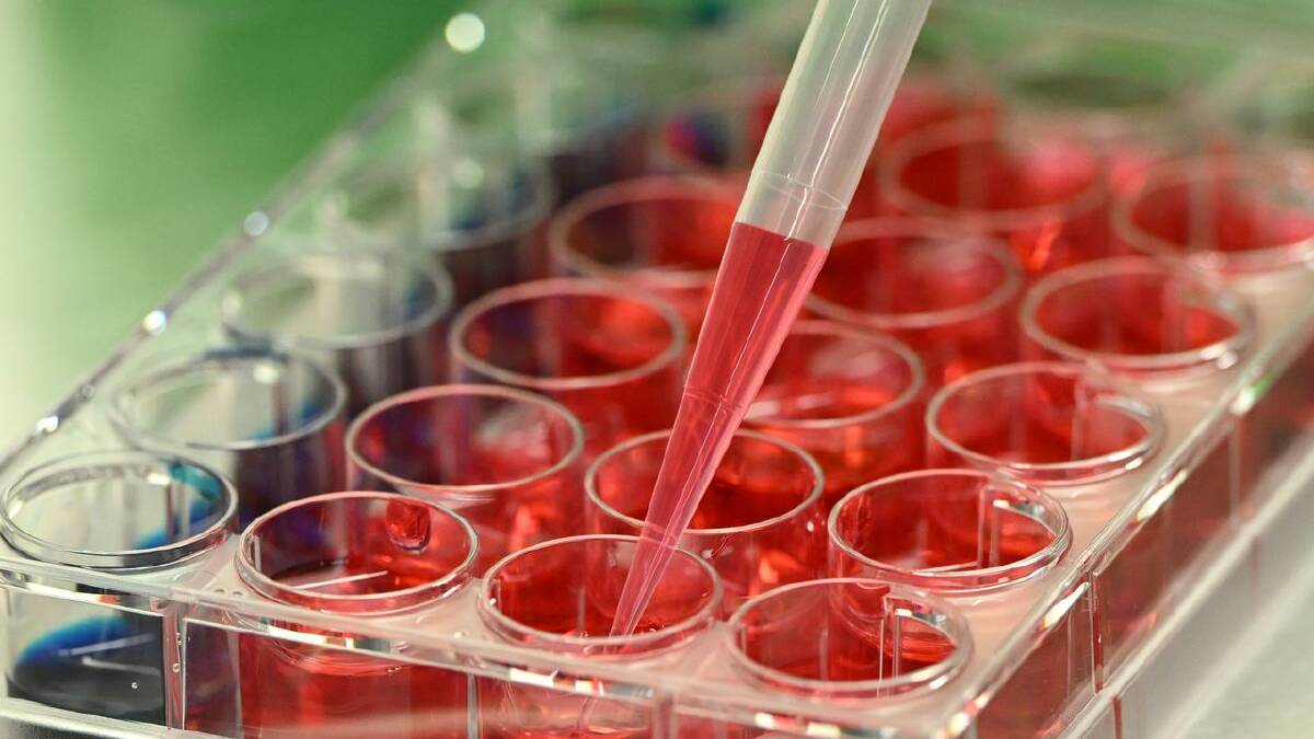 Australia's investment in global health research lags behind other countries, the report says. (Joel Carrett/AAP PHOTOS) Australia's investment in global health research lags behind other countries, the report says. (Joel Carrett/AAP PHOTOS)